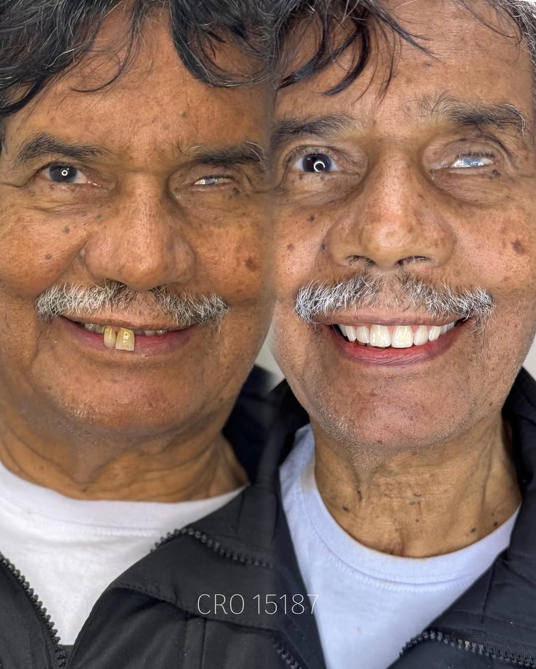 Transformação de Sorriso 5