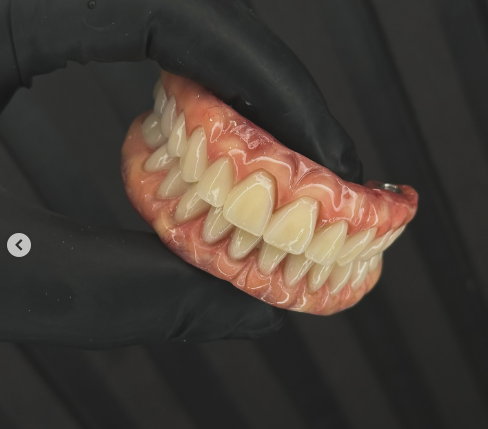 Implantes & Protocolos