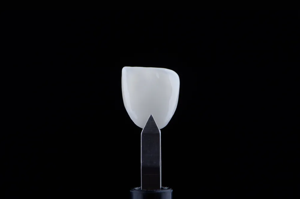 Lentes de Porcelana